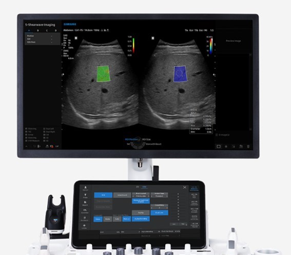 Monitor de elastografía hepática para evaluar la rigidez del hígado en casos de hígado graso y cirrosis