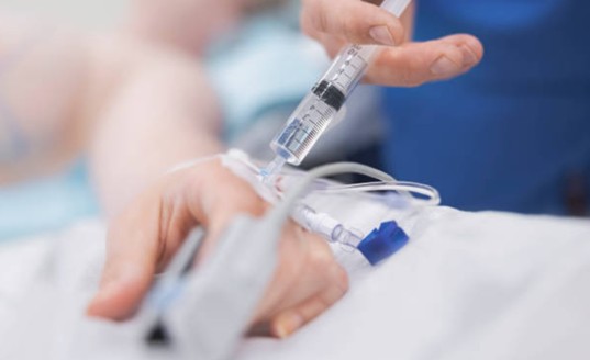 Aplicación de sedación intravenosa durante procedimiento de endoscopia digestiva